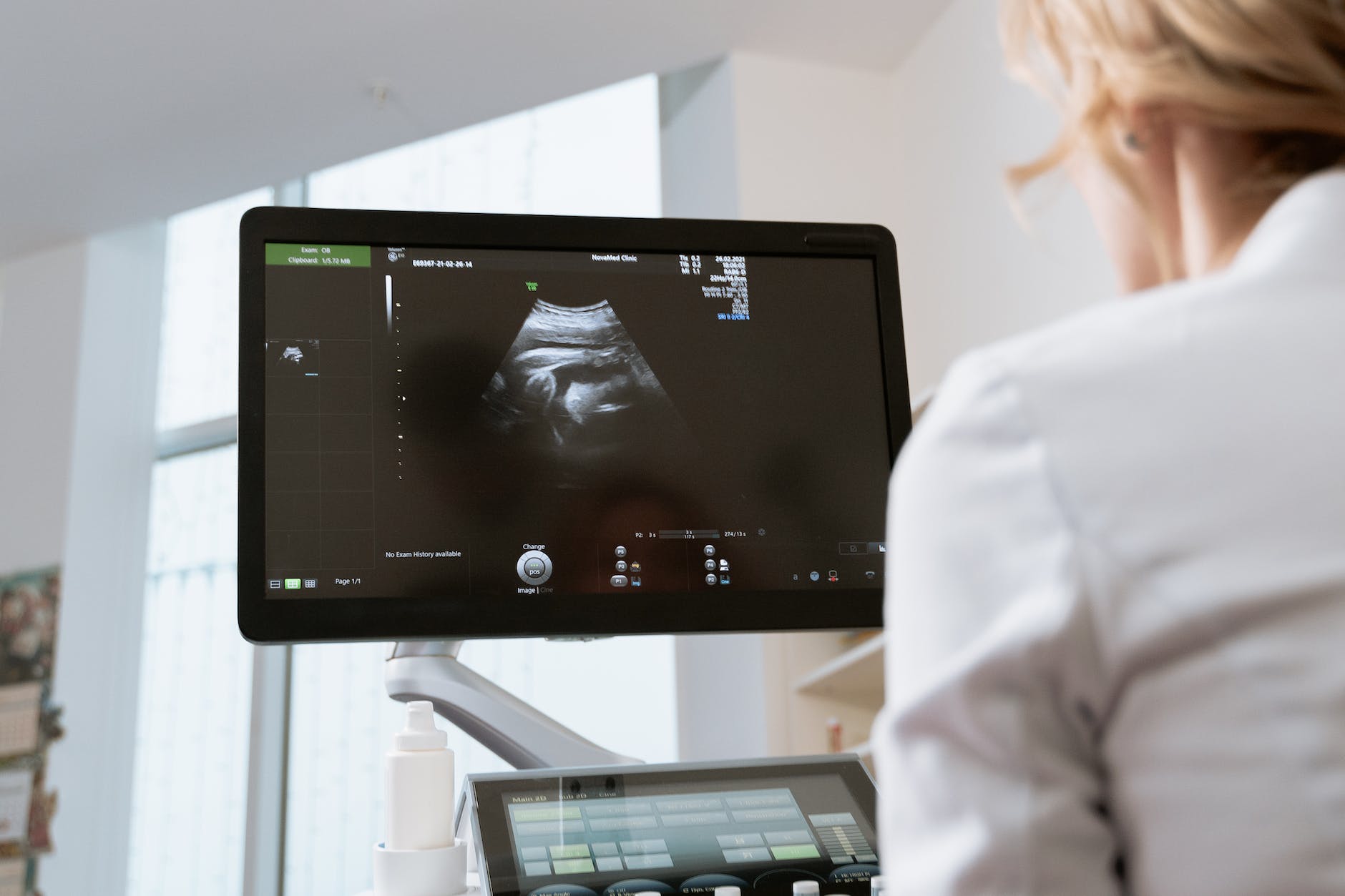 photo of an ob gyn looking in the monitor